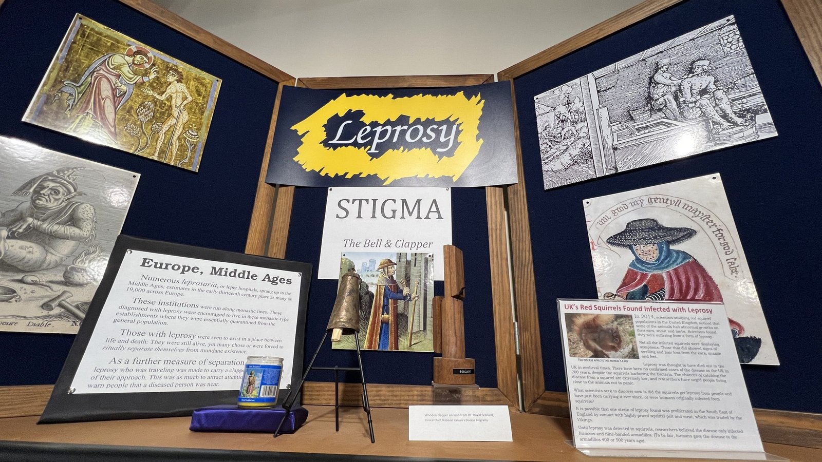 LeprosyStigma