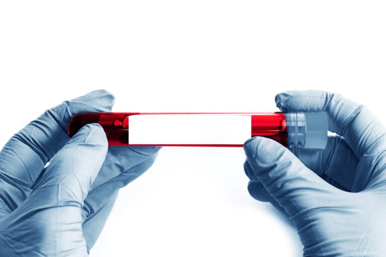 Close up of scientist hand with a blood ampoule