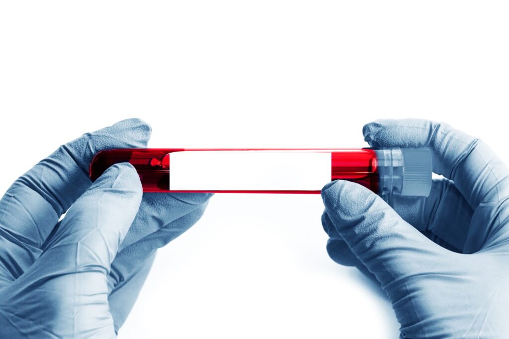 Close up of scientist hand with a blood ampoule